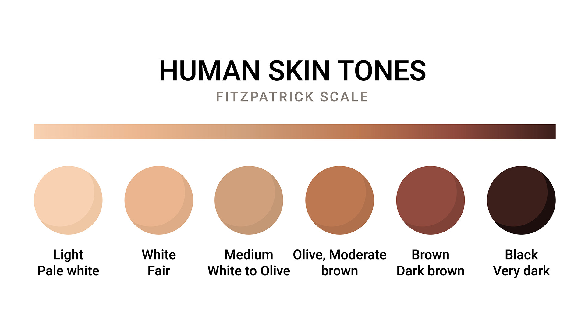 Fitzpatrick’s Scale