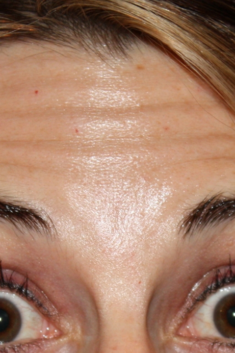 Female injectables