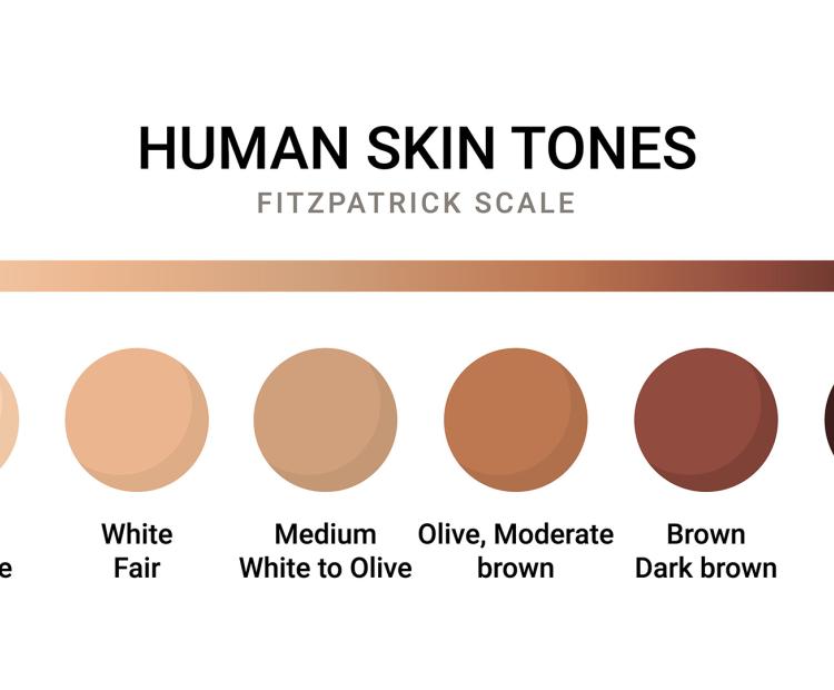 Fitzpatrick’s Scale